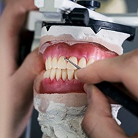dentures being crafted in a plaster mold