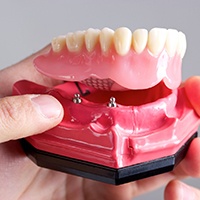 implant dentist in Bellingham holding a model of an implant denture 